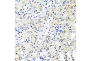 Immunohistochemistry of paraffin-embedded Mouse kidney using TRIM27 antibody (ABIN7269922) at dilution of 1:100 (40x lens).