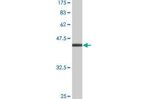 Western Blot detection against Immunogen (37. (Retinoic Acid Receptor alpha antibody  (AA 315-424))