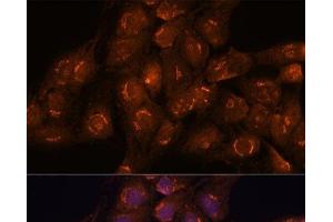 Immunofluorescence analysis of C6 cells using ACBD3 Polyclonal Antibody at dilution of 1:100. (ACBD3 antibody)