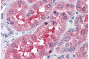 Human Kidney: Formalin-Fixed, Paraffin-Embedded (FFPE) (BBOX1 antibody  (AA 278-388))