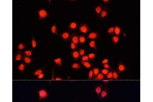 Immunofluorescence analysis of HeLa cells using BACH1 Polyclonal Antibody at dilution of 1:100. (BACH1 antibody)