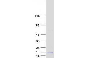 Validation with Western Blot (AGRP Protein (Transcript Variant 1) (Myc-DYKDDDDK Tag))