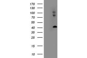 HEK293T cells were transfected with the pCMV6-ENTRY control (Left lane) or pCMV6-ENTRY LMCD1 (Right lane) cDNA for 48 hrs and lysed. (LMCD1 antibody)