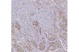 IHC analysis of WDR44 using anti-WDR44 antibody (ABIN7600394). (WDR44 antibody  (AA 188-913))