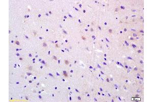 Formalin-fixed and paraffin embedded rat brain labeled with Anti-ADCY8 Polyclonal Antibody, Unconjugated (ABIN751228) at 1:200 followed by conjugation to the secondary antibody and DAB staining. (ADCY8 antibody  (AA 151-250))