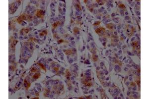 Immunohistochemistry (IHC) image for anti-Dihydrofolate Reductase (DHFR) antibody (ABIN7127454)