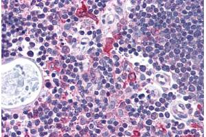 Human Thymus (formalin-fixed, paraffin-embedded) stained with CHEK1 antibody ABIN214737 at 5 ug/ml followed by biotinylated goat anti-rabbit IgG secondary antibody ABIN481713, alkaline phosphatase-streptavidin and chromogen. (CHEK1 antibody  (AA 192-241))