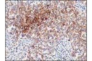 Immunohistochemistry (IHC) image for anti-Placental Alkaline Phosphatase (ALPP) antibody (ABIN870410)