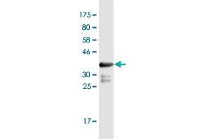 Western Blot detection against Immunogen (36. (PDPK1 antibody  (AA 457-556))