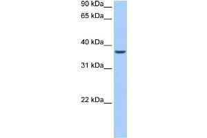 ALKBH8 antibody used at 0. (ALKBH8 antibody)