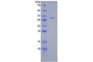 SDS-PAGE analysis of Human HSPG2 Protein. (HSPG2 Protein)
