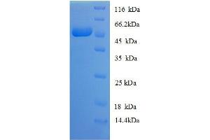 Myelin Basic Protein (MBP) (AA 134-304), (partial) protein (GST tag) (MBP Protein (AA 134-304, partial) (GST tag))
