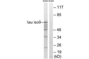 Western blot analysis of extracts from rat brain cells, using Tau (Ab-717/400) antibody. (MAPT antibody  (Ser400, Ser717))