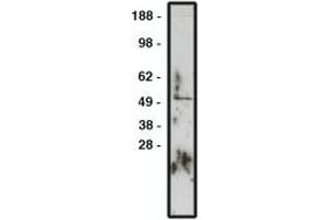 Image no. 1 for anti-Zinc Finger Protein GLI1 (GLI1) antibody (ABIN793725) (GLI1 antibody)