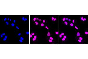 Immunocytochemical staining of HT- cells with Phospho-AKT1 (T450) antibody (ABIN7800786), 1:1,000). (Recombinant AKT1 antibody  (pThr450))