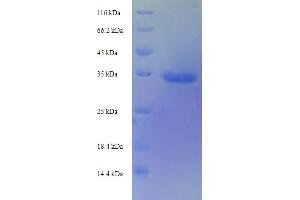 SDS-PAGE (SDS) image for TIMP Metallopeptidase Inhibitor 1 (TIMP1) (AA 25-205) protein (His-SUMO Tag) (ABIN5710496) (TIMP1 Protein (AA 25-205) (His-SUMO Tag))