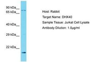 Image no. 1 for anti-DEAH (Asp-Glu-Ala-His) Box Polypeptide 40 (DHX40) (N-Term) antibody (ABIN6750559) (DEAH (Asp-Glu-Ala-His) Box Polypeptide 40 (DHX40) (N-Term) antibody)