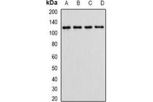 Western blot analysis of Alpha E-catenin expression in HEK293T (A), MCF7 (B), mouse kidney (C), mouse brain (D) whole cell lysates. (CTNNA1 antibody)