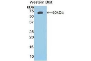 Western blot analysis of the recombinant protein. (IGFBP2 antibody  (AA 24-305))