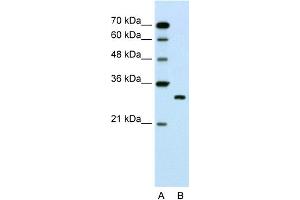 WB Suggested Anti-SBDS Antibody Titration:  1. (SBDS antibody  (C-Term))