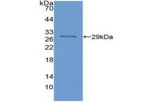Detection of Recombinant FOXP3, Human using Polyclonal Antibody to Forkhead Box P3 (FOXP3) (FOXP3 antibody  (AA 191-412))