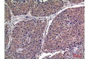 Immunohistochemistry (IHC) analysis of paraffin-embedded Human Lung, antibody was diluted at 1:100. (IGFBPI antibody  (Internal Region))