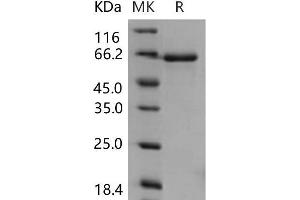 Western Blotting (WB) image for EPH Receptor B3 (EPHB3) (Active) protein (His tag) (ABIN7195552) (EPH Receptor B3 Protein (EPHB3) (His tag))