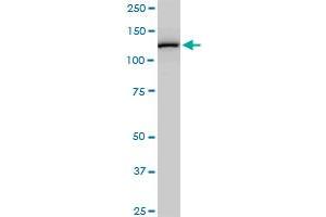 CAND1 monoclonal antibody (M03), clone 2D7. (CAND1 antibody  (AA 1-100))