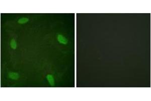 Immunofluorescence analysis of HeLa cells treated with Forskolin 40nM 30', using SSB (Phospho-Ser366) Antibody. (SSB antibody  (pSer366))