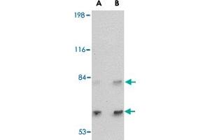 Western blot analysis of SATB2 in A-20 cell lysate with SATB2 polyclonal antibody  at (A) 2 and (B) 4 ug/mL . (SATB2 antibody  (C-Term))