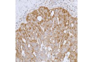Immunohistochemistry (IHC) image for anti-Peroxiredoxin 3 (PRDX3) (AA 206-256) antibody (ABIN7453415)