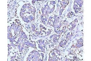 IHC analysis of ITCH/AIP4 using anti-ITCH/AIP4 antibody (ABIN7600263). (ITCH antibody  (AA 17-358))