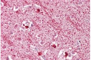 Anti-DAP3 antibody IHC staining of human brain, cortex. (DAP3 antibody  (AA 387-398))