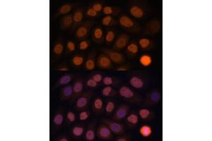 Immunofluorescence analysis of HeLa cells using KLF6 antibody (ABIN6131578, ABIN6142923, ABIN6142924 and ABIN6214111) at dilution of 1:100.