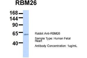 Host:  Rabbit  Target Name:  RBM26  Sample Type:  Human Fetal Heart  Antibody Dilution:  1. (RBM26 antibody  (Middle Region))