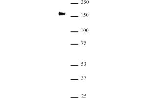 Western Blotting (WB) image for anti-SWI/SNF Related, Matrix Associated, Actin Dependent Regulator of Chromatin, Subfamily C, Member 2 (SMARCC2) (C-Term) antibody (ABIN6972747)