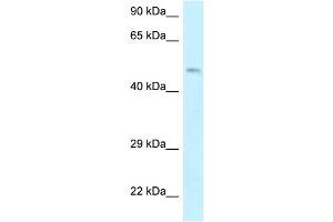 WB Suggested Anti-EPB49 Antibody Titration: 1. (Dematin antibody  (Middle Region))
