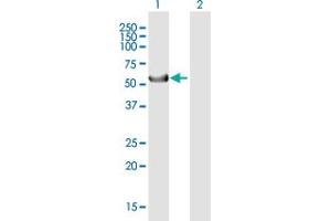 Western Blot analysis of KRT39 expression in transfected 293T cell line by KRT39 MaxPab polyclonal antibody. (Keratin 39 (KRT39) (AA 1-491) antibody)