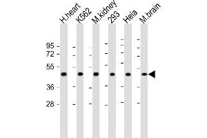 All lanes : Anti-hGDF11-R47 at 1:2000 dilution Lane 1: human heart lysate Lane 2: K562 whole cell lysate Lane 3: mouse kidney lysate Lane 4: 293 whole cell lysate Lane 5: Hela whole cell lysate Lane 5: mouse brain lysate Lysates/proteins at 20 μg per lane. (GDF11 antibody  (N-Term))