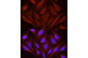 Immunofluorescence analysis of U2OS cells using JNK1/2/3 Rabbit pAb (ABIN7268630) at dilution of 1:100 (40x lens). (MAPK8/9/10 antibody)