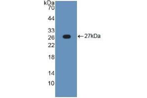 Western blot analysis of recombinant Human TNFRSF1A.