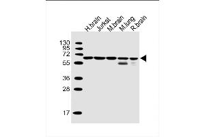 Lane 1: human brain, Lane 2: Jurkat, Lane 3: mouse brain, Lane 4: mouse lung, Lane 5: rat brain cell lysate at 20 µg per lane, probed with bsm-51443M PPP2R1B (1496CT356. (PPP2R1B antibody)