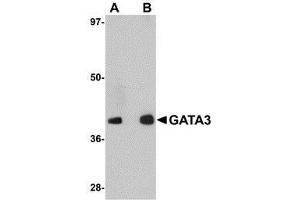 Western blot analysis of GATA3 in human brain tissue lysate with AP30358PU-N GATA3 antibody at (A) 1 and (B) 2 μg/ml. (GATA3 antibody  (C-Term))