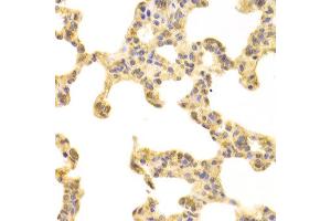 Immunohistochemistry of paraffin-embedded rat lung using FABP4 antibody at dilution of 1:100 (x400 lens). (FABP4 antibody)