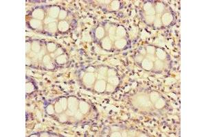 Immunohistochemistry of paraffin-embedded human colon tissue using ABIN7171536 at dilution of 1:100 (TAS2R13 antibody  (AA 150-184))