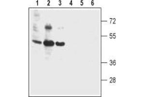 Western blot analysis of human colon cancer cell lines Colo-205 (lanes 1 and 4), human T-84 colonic adenocarcinoma cell line (lanes 2 and 5) and human colon cancer HT-29 cell line (lanes 3 and 6): - 1-3.