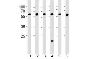 Western blot analysis of lysate from 1) 293, 2) HepG2, 3) HUVEC, 4) Raji, 5) rat C6 and 6) mouse C2C12 cell line using SPHK1 antibody at 1:1000. (SPHK1 antibody  (AA 286-315))