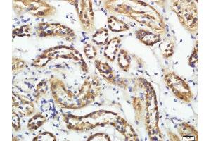 Immunohistochemistry (Paraffin-embedded Sections) (IHC (p)) image for anti-CD200 Receptor 1-Like (CD200R1L) (AA 151-250) antibody (ABIN1715098)