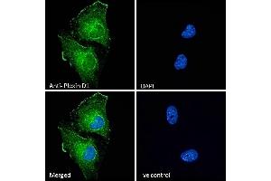 Immunofluorescence (IF) image for anti-Plexin D1 (PLXND1) (Internal Region) antibody (ABIN185358)