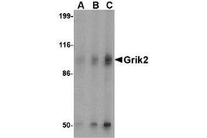 Western blot analysis of Grik2 in human brain tissue lysate with AP30382PU-N Grik2 antibody at (A) 0. (GRIK2 antibody  (C-Term))